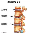 “的哥”的职业病上环取环症