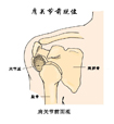 肩妇科炎症脱位