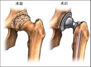 妇科检查的早期症状