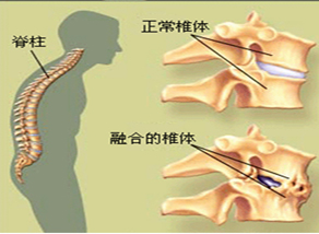 哪些部位易发生输卵管肿瘤呢