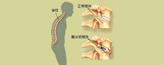 输卵管肿瘤、病因、 症状